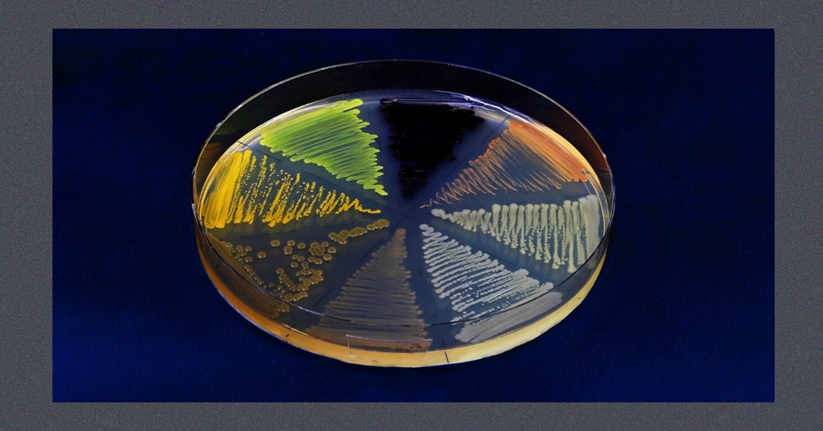 Close-up photo of a petri dish with agar containing colored microorganisms and bacteria. The Petri dish is on a dark blue background with a blue speckled frame.