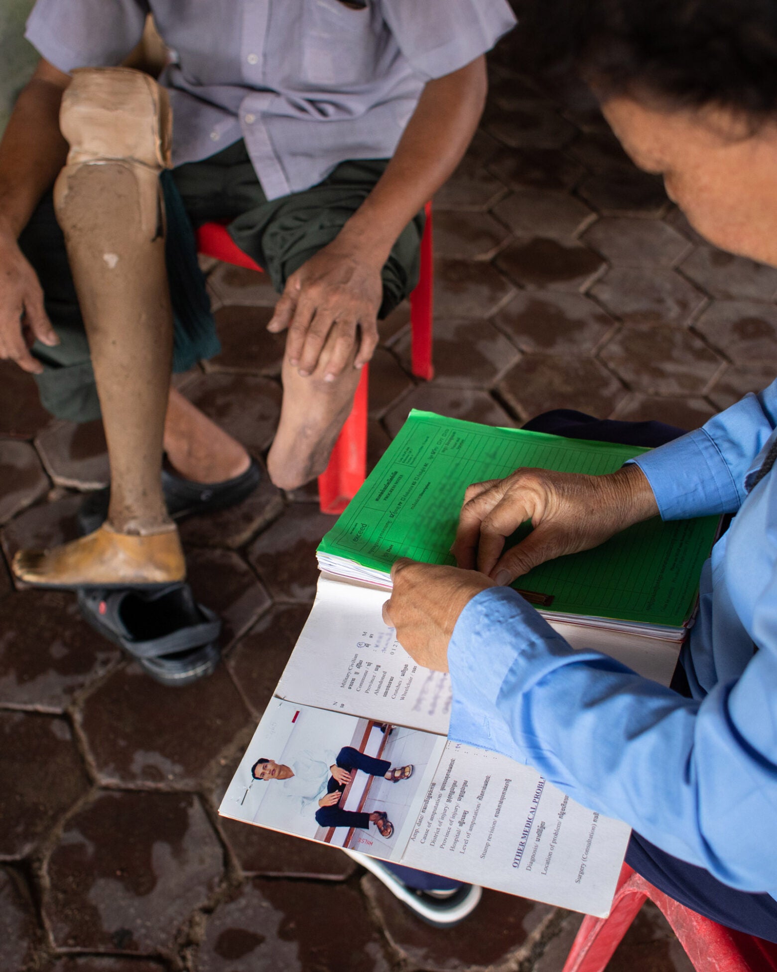 A prosthetics patient with a missing leg limb gets his chart reviewed and leg cared for a by a community health care worker near his home in Cambodia.