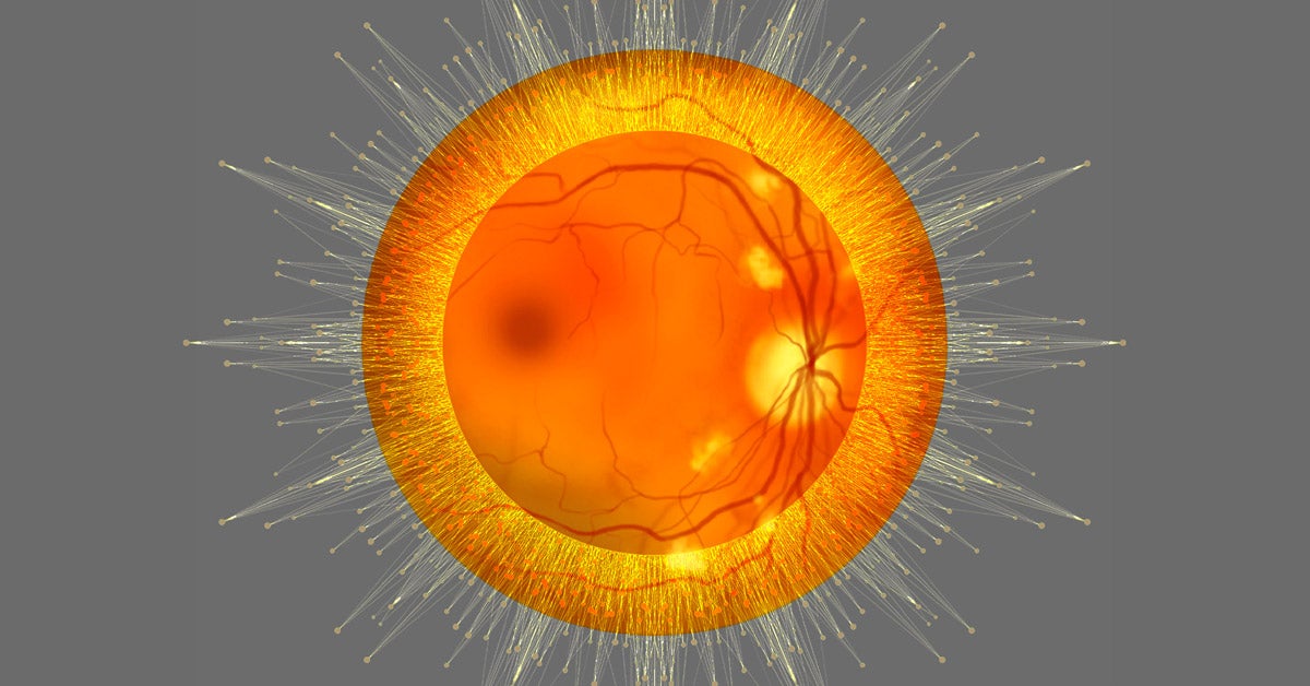 Digital illustration: Diabetic retinopathy, ophthalmoscopic diagnosis image. Yellow, data-like dots radiate around it.